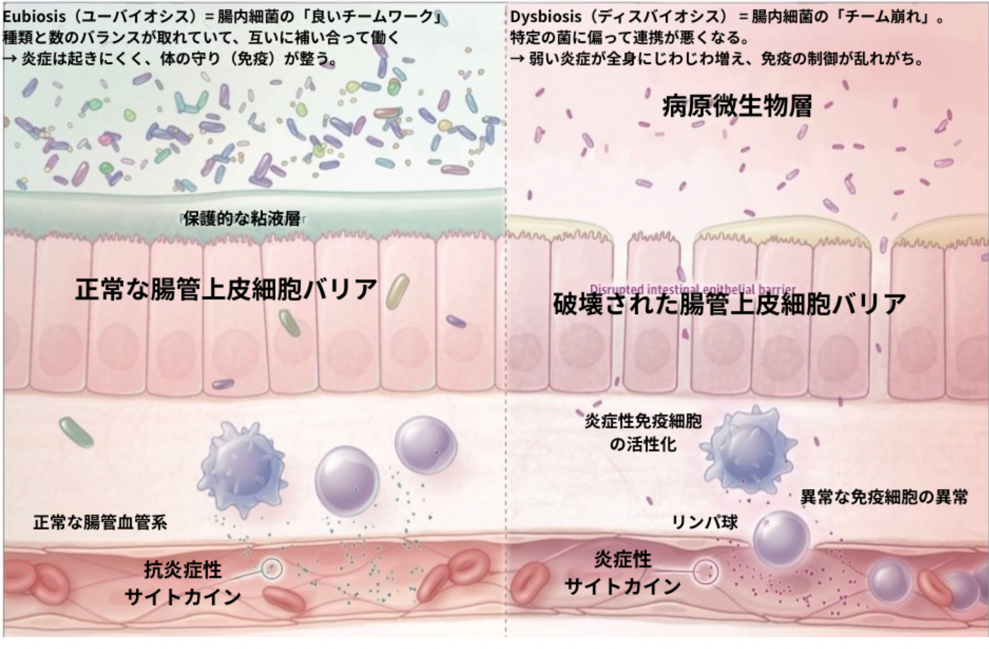 腸内環境と健康状態の比較図