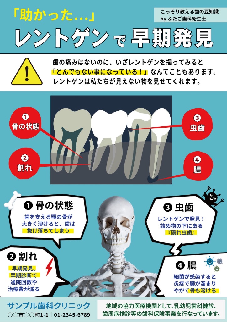 レントゲンで早期発見
