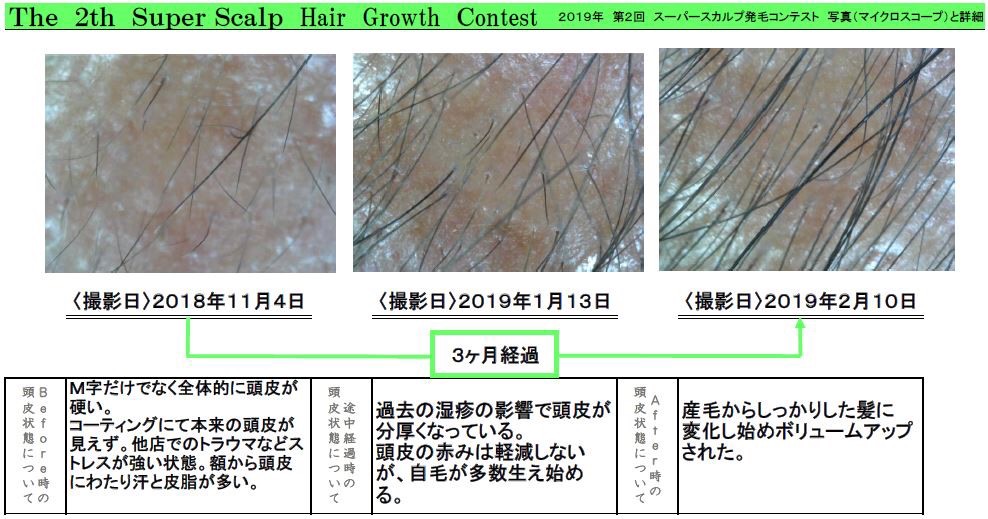 頭皮の変化
