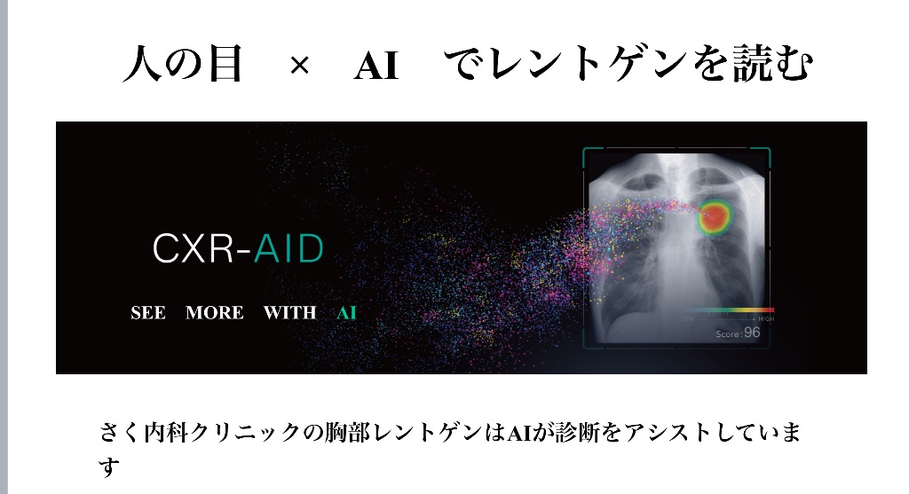 CXR-AID システム - 人の目とAIでレントゲンを読む