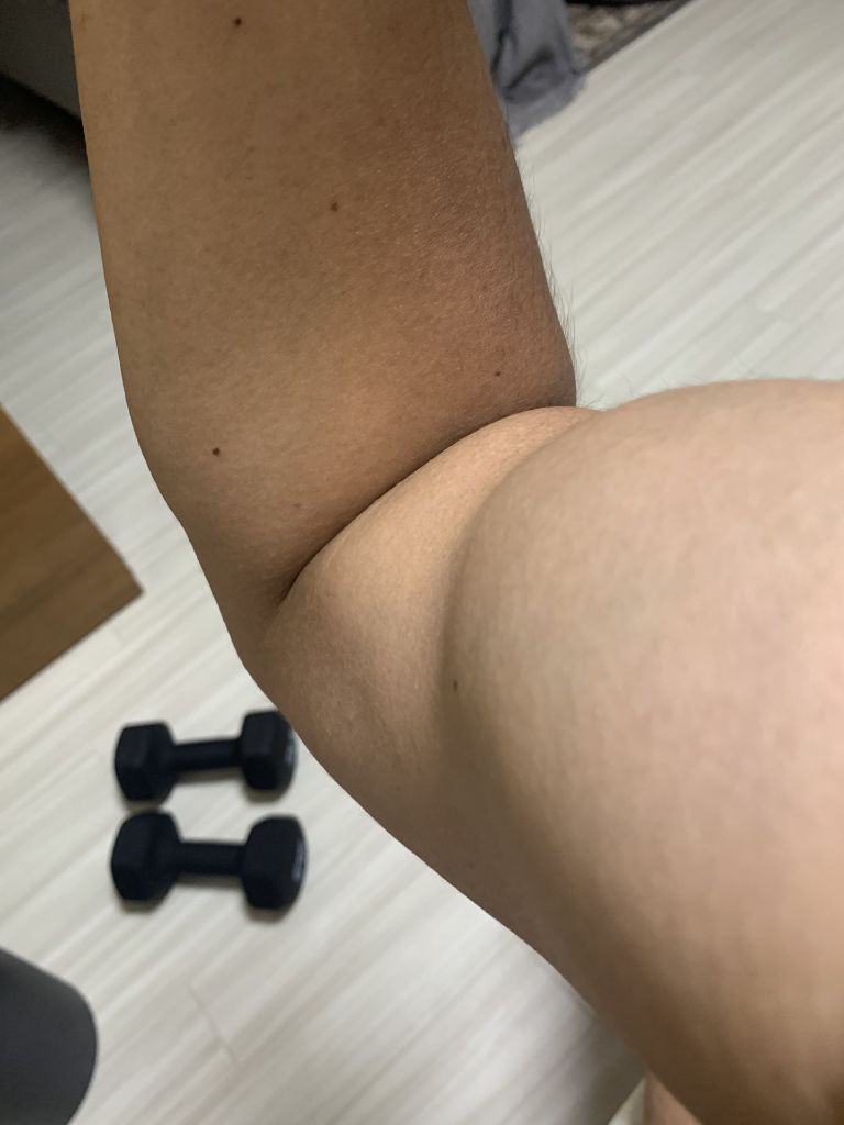 ADPKD患者の軽い筋力トレーニング - ダンベルを使った腕の運動
