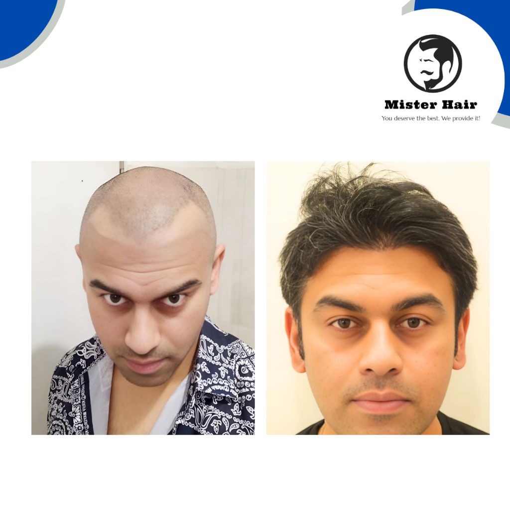 Before After Result 3