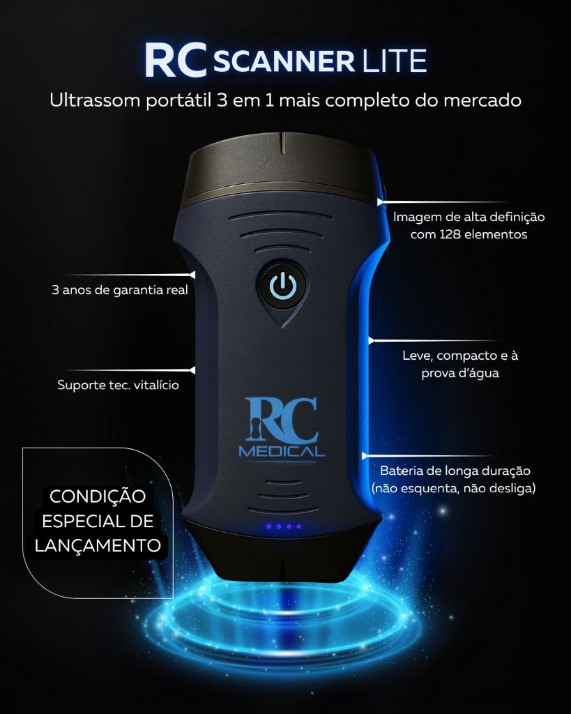 RC Scanner Lite