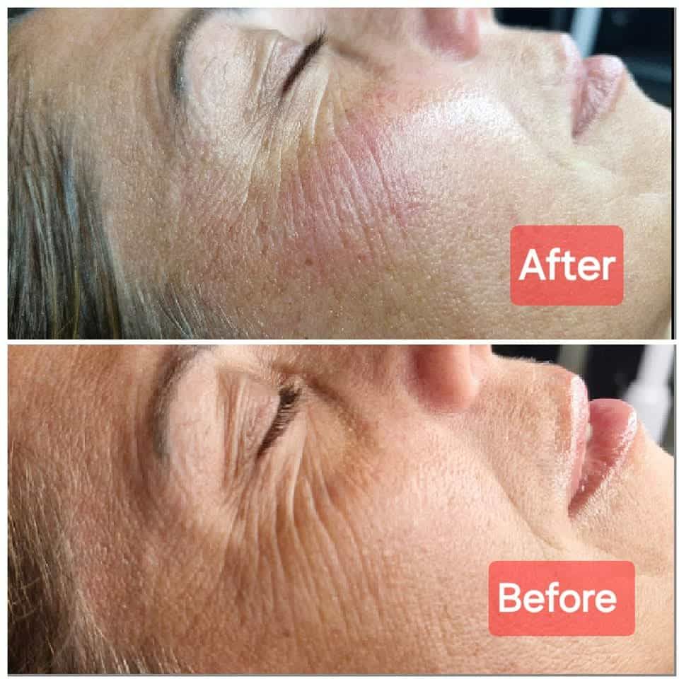 Before and After Instant Skin Refresher - Close-up showing texture transformation