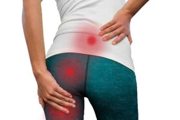 Anatomia da dor lombar - áreas de irradiação da dor nas costas e quadril