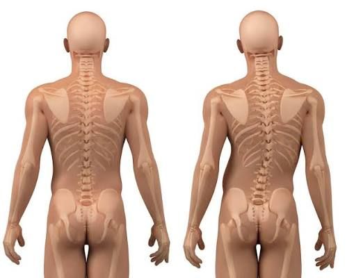 Anatomia da coluna vertebral - diferenças entre coluna normal e escoliose