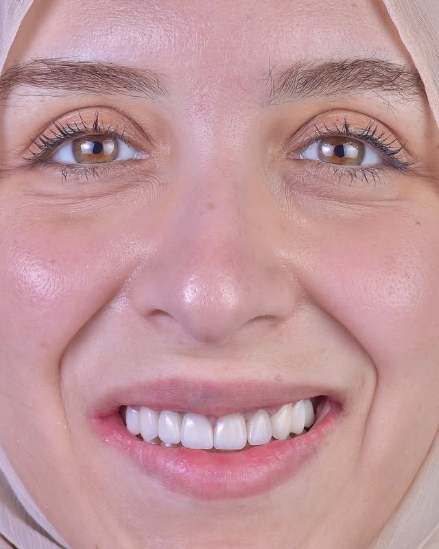 Smile transformation